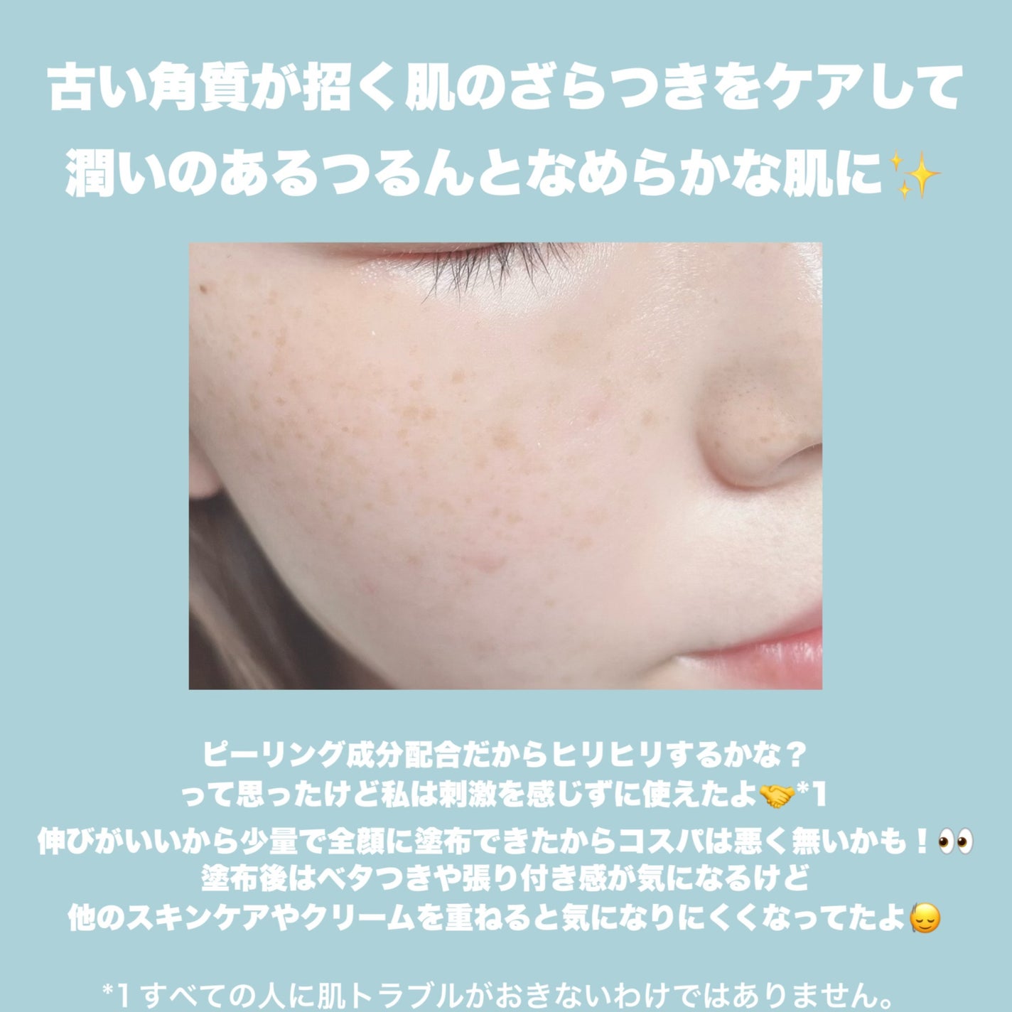 エファクラ ピールケア セラム/ラ ロッシュ ポゼ/美容液を使ったクチコミ(4枚目)