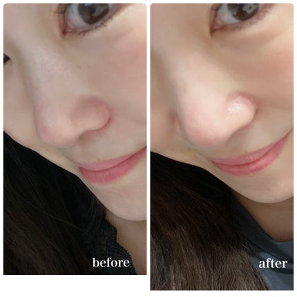 AZケア クレンジングオイル/VT/オイルクレンジングを使ったクチコミ(5枚目)