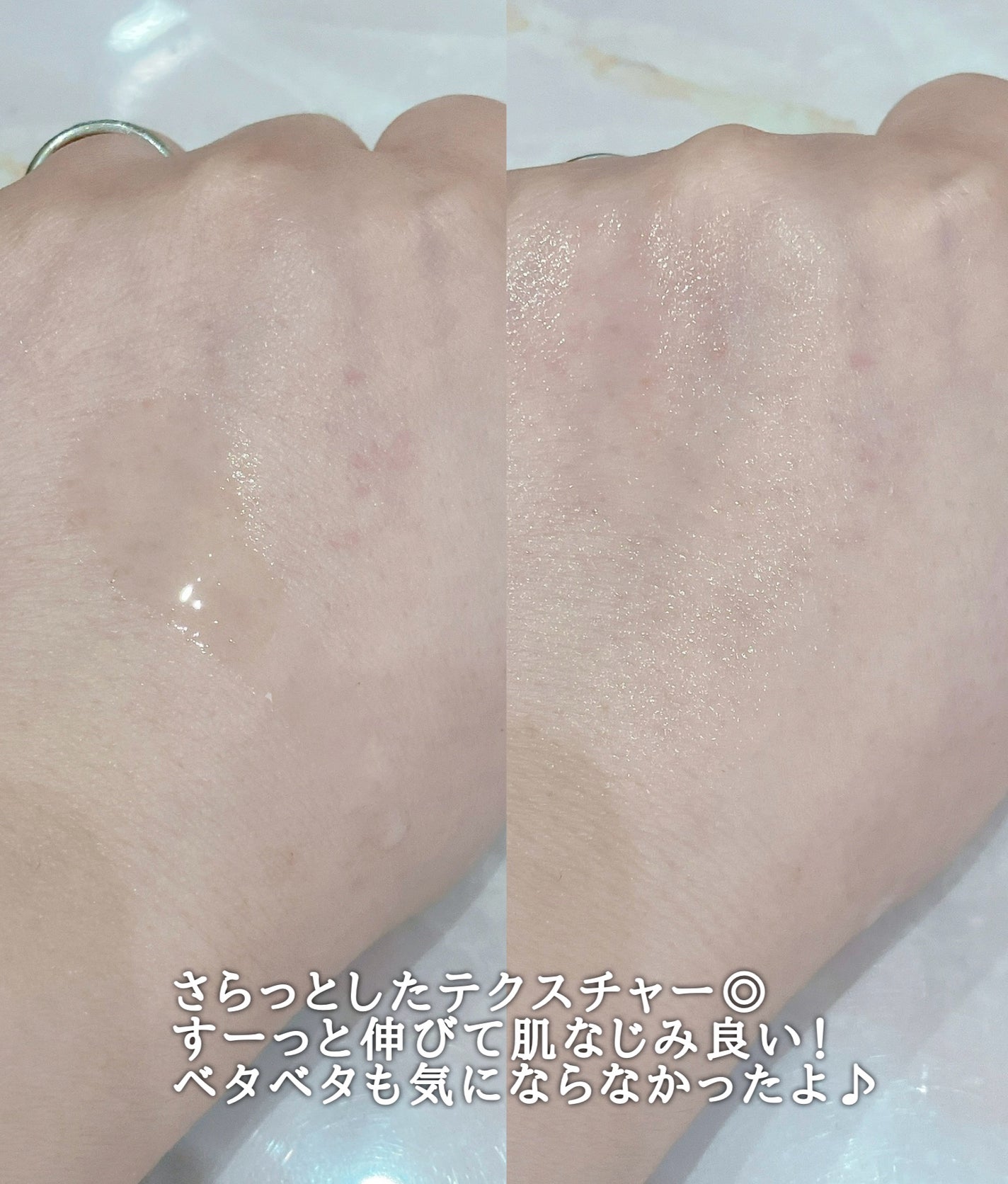 ダーマアンサーアゼライン酸ミントアンプル/CNP Laboratory/美容液を使ったクチコミ(3枚目)