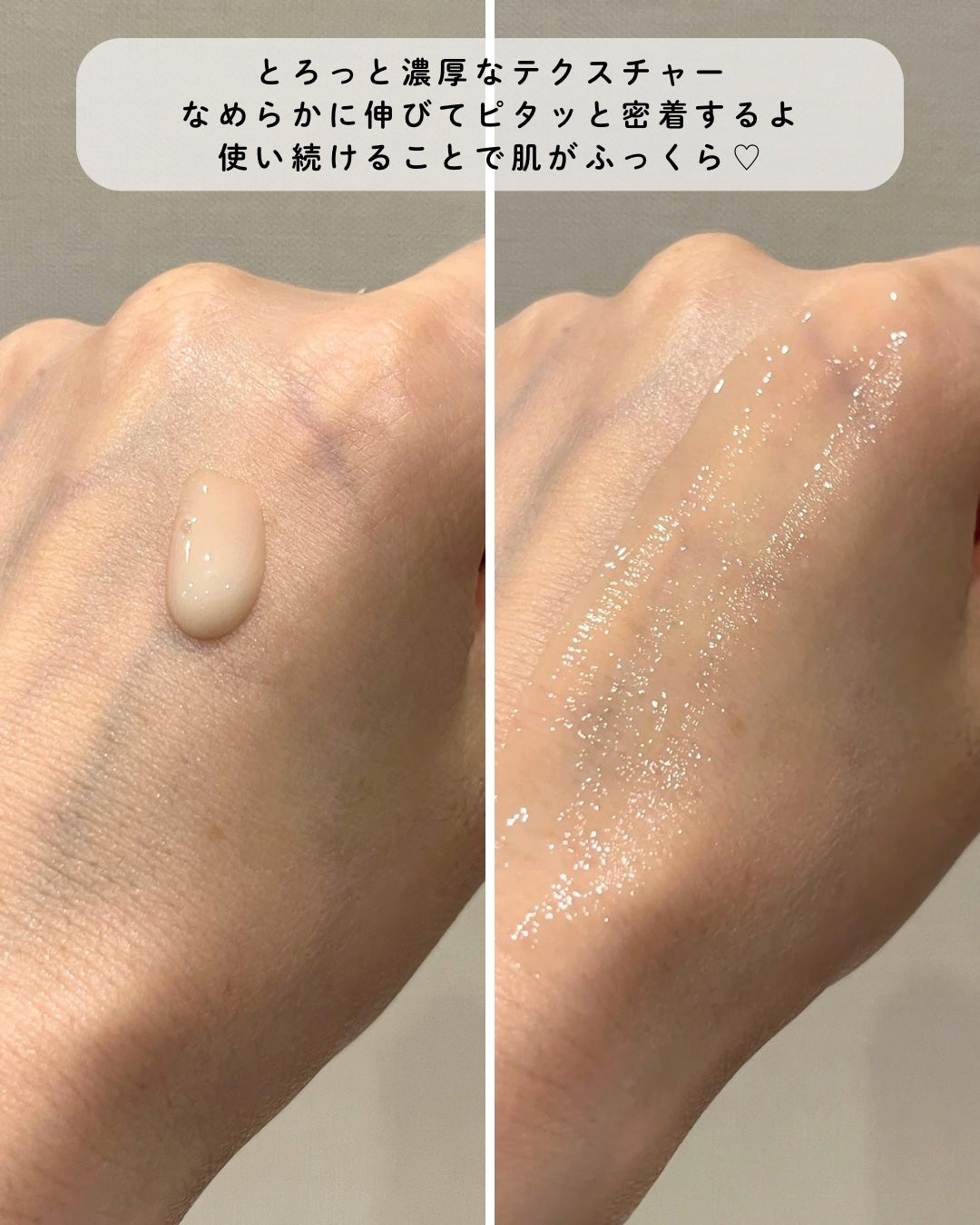 アットクリニックリンクルショットアンプル/DOMINAS/美容液を使ったクチコミ(4枚目)