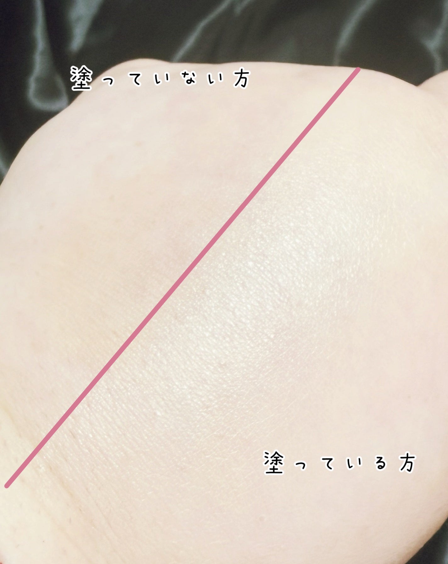 ディオールスキン フォーエヴァー イドラ グロウ クッション(リフィル)/Dior/クッションファンデーションを使ったクチコミ(3枚目)