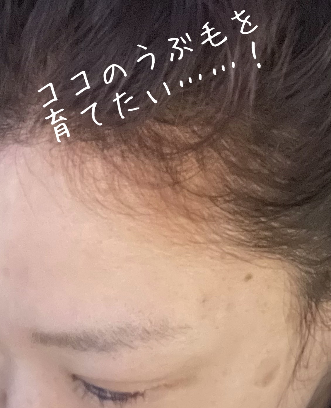 薬用 メディカル アンチヘアロスセラム/L'OCCITANE/頭皮ローションを使ったクチコミ（1枚目）