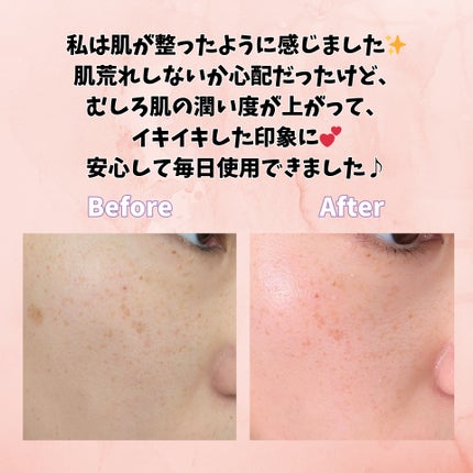 SOOTHING REPAIR TONING SERUM R4/ダーマファーム/美容液を使ったクチコミ(5枚目)