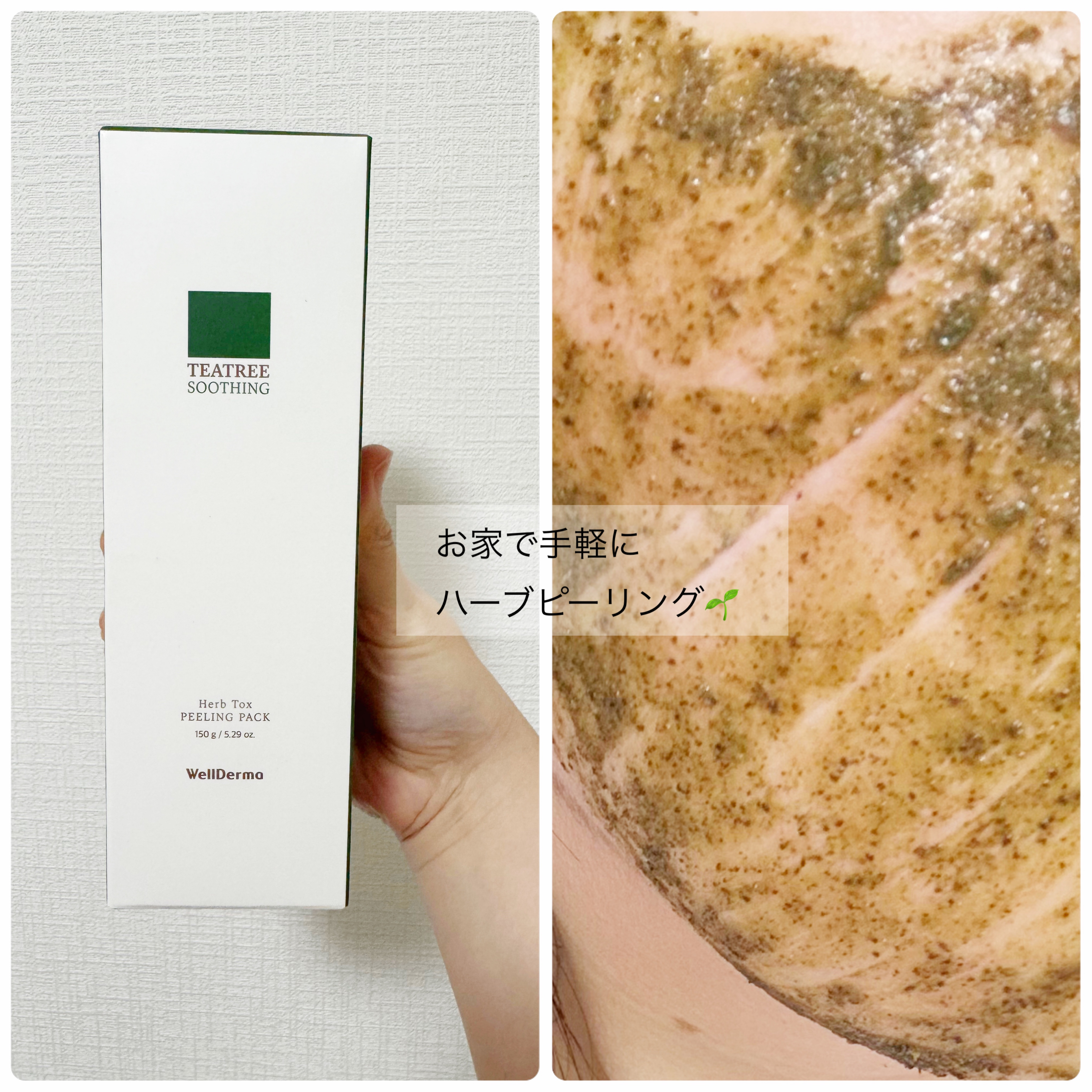 ティーツリーハーブピーリングパック/WellDerma/洗い流すパック・マスクを使ったクチコミ（1枚目）