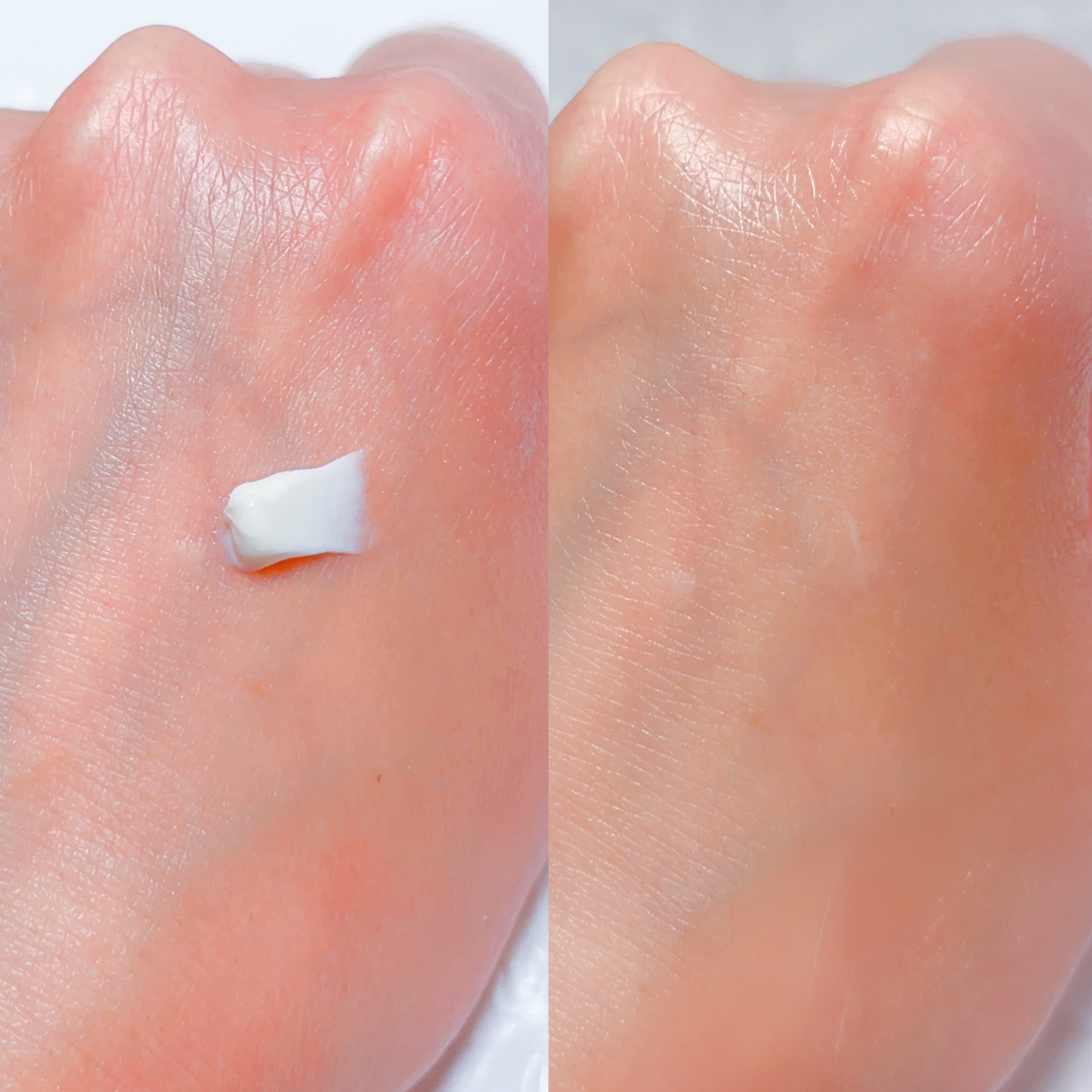 バルサミック ユーカリクリーム/ARGITAL/ボディクリームを使ったクチコミ（3枚目）