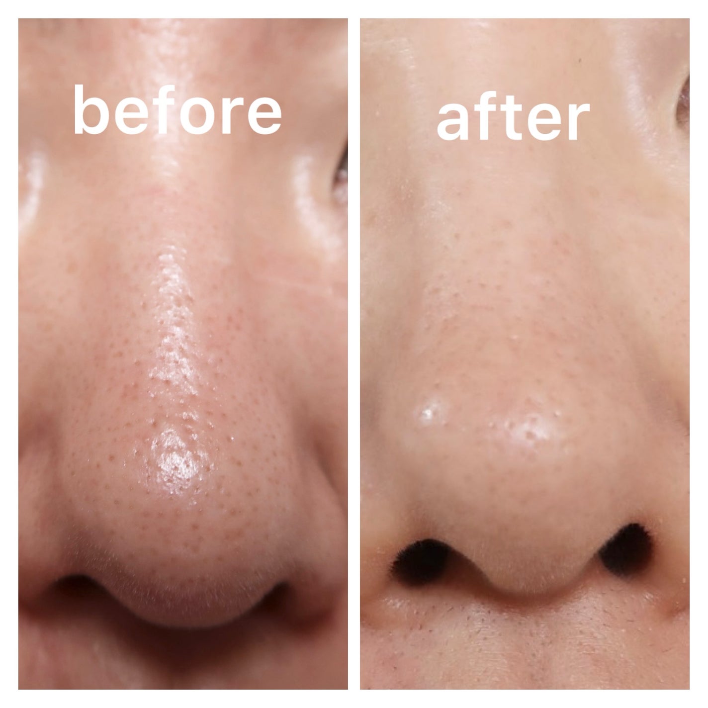 AZケア クレンジングオイル/VT/オイルクレンジングを使ったクチコミ(3枚目)