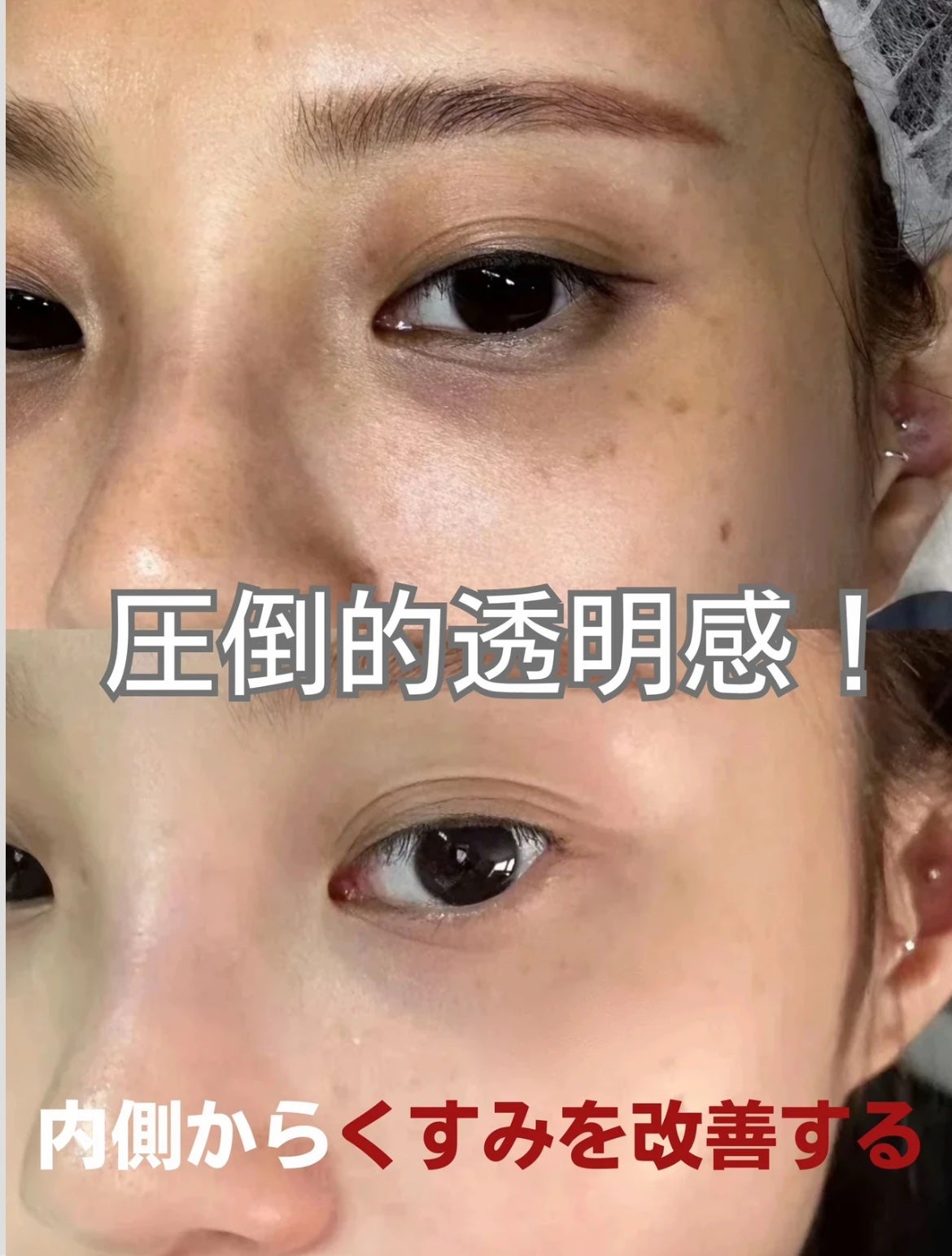 桃花姫プラセンタ/和漢SINCA/美容サプリメントを使ったクチコミ(3枚目)