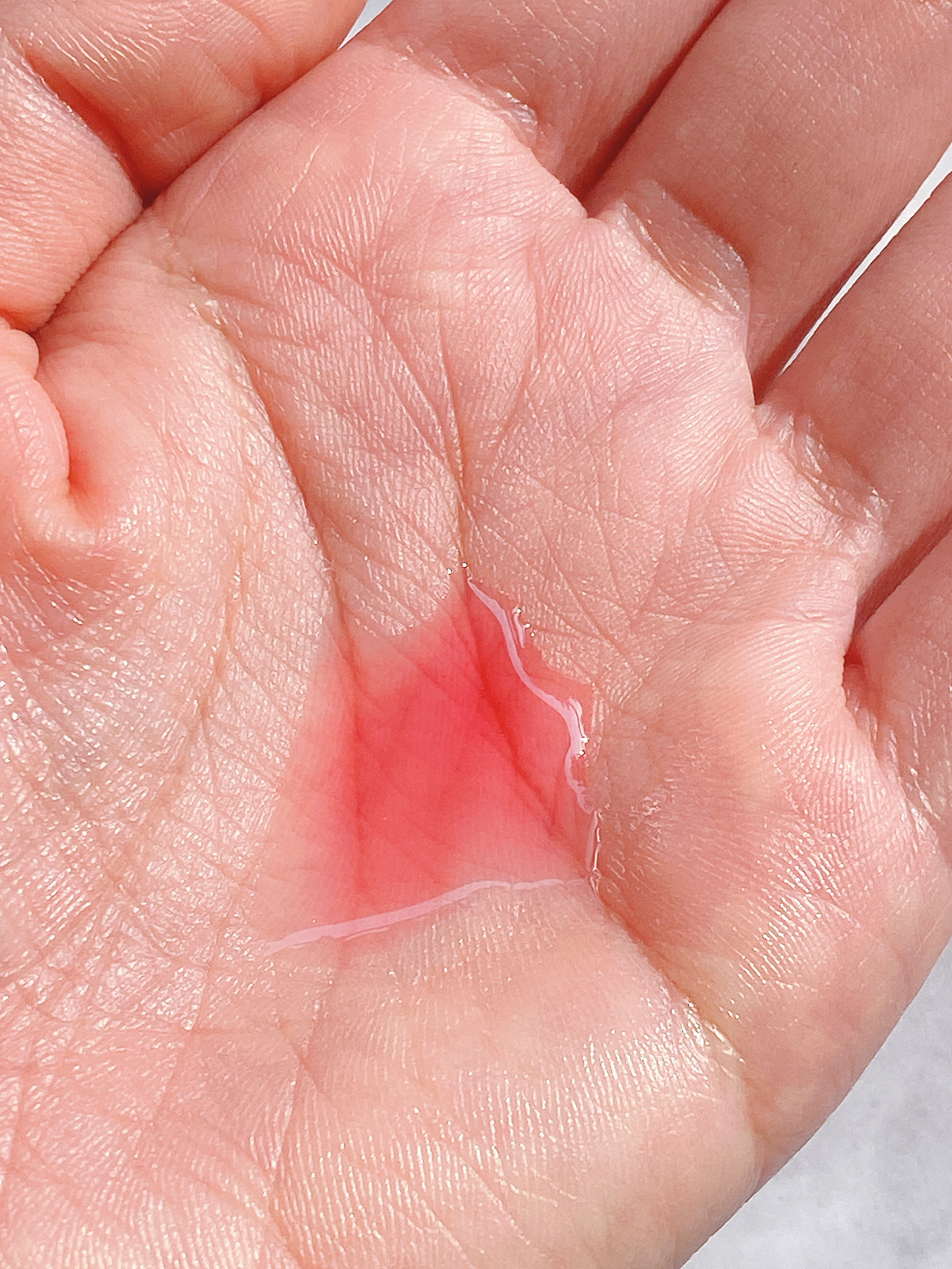 A1カーミング アンプル/VT/美容液を使ったクチコミ（3枚目）