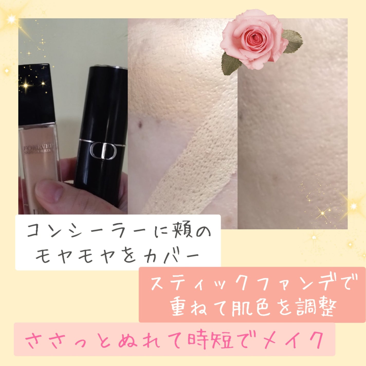 ディオールスキン フォーエヴァー スキン コレクト コンシーラー/Dior/リキッドコンシーラーを使ったクチコミ(4枚目)