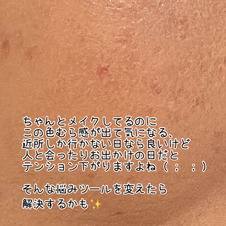 マシュマロフィニッシュパウダー/キャンメイク/プレストパウダーを使ったクチコミ（2枚目）