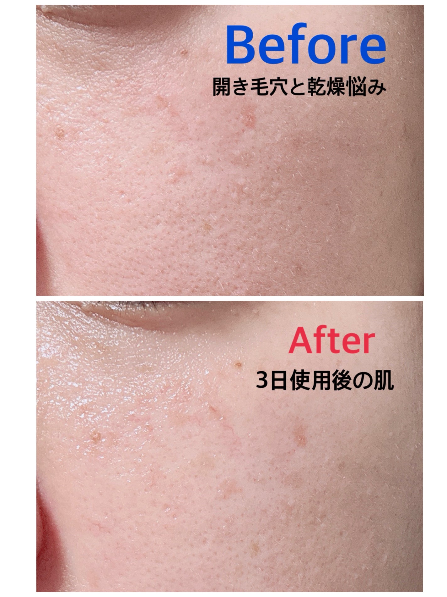 リードルS PDRN+ セラム/VT/美容液を使ったクチコミ(4枚目)