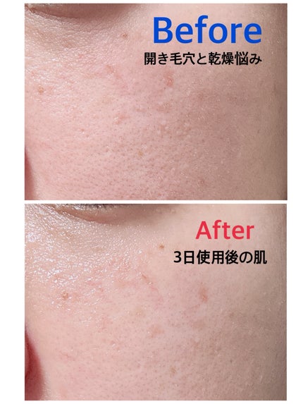 リードルS PDRN+ セラム/VT/美容液を使ったクチコミ(4枚目)