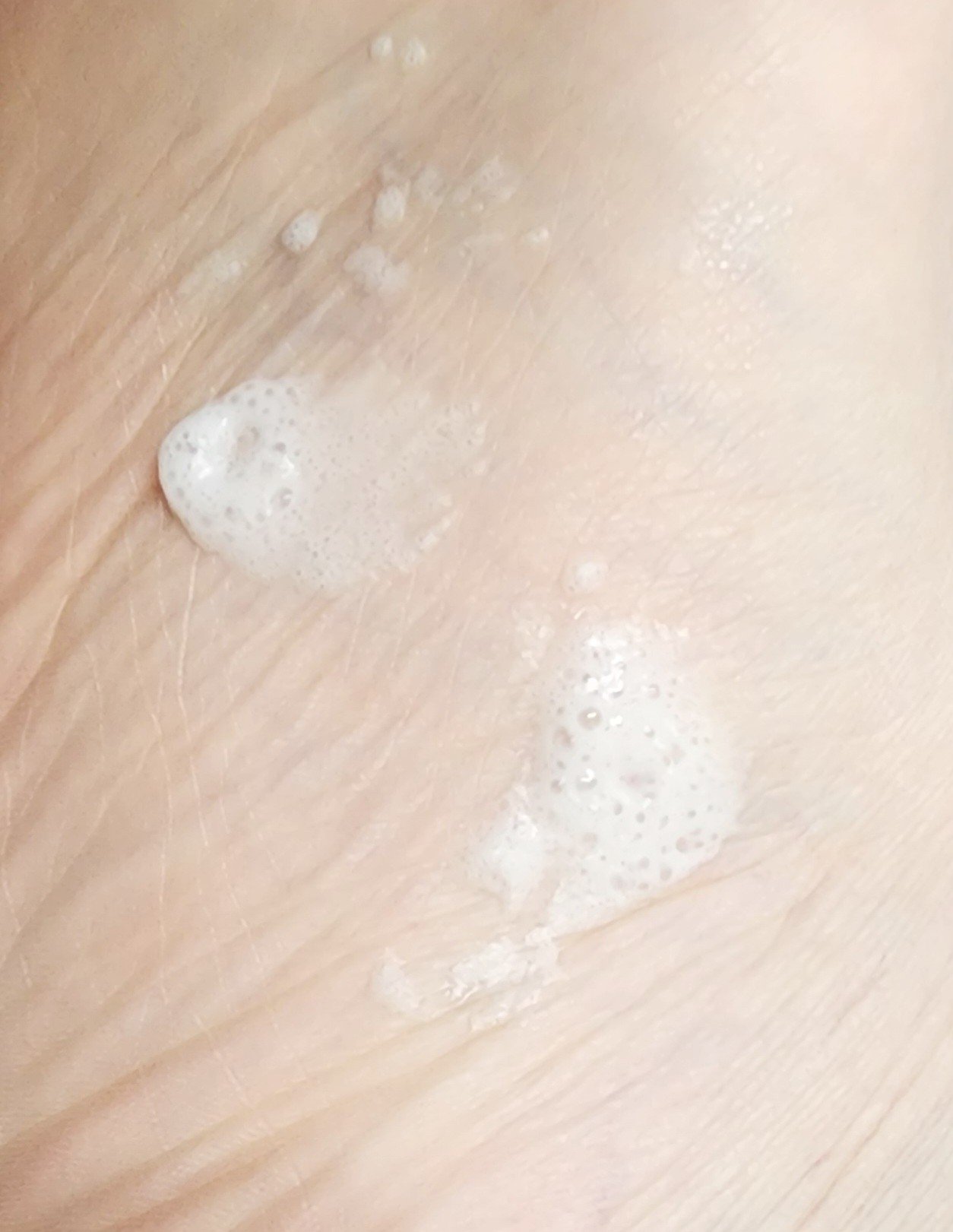 ベビーフット 炭酸泡フットドライシャンプー/ベビーフット/レッグ・フットケアを使ったクチコミ（3枚目）