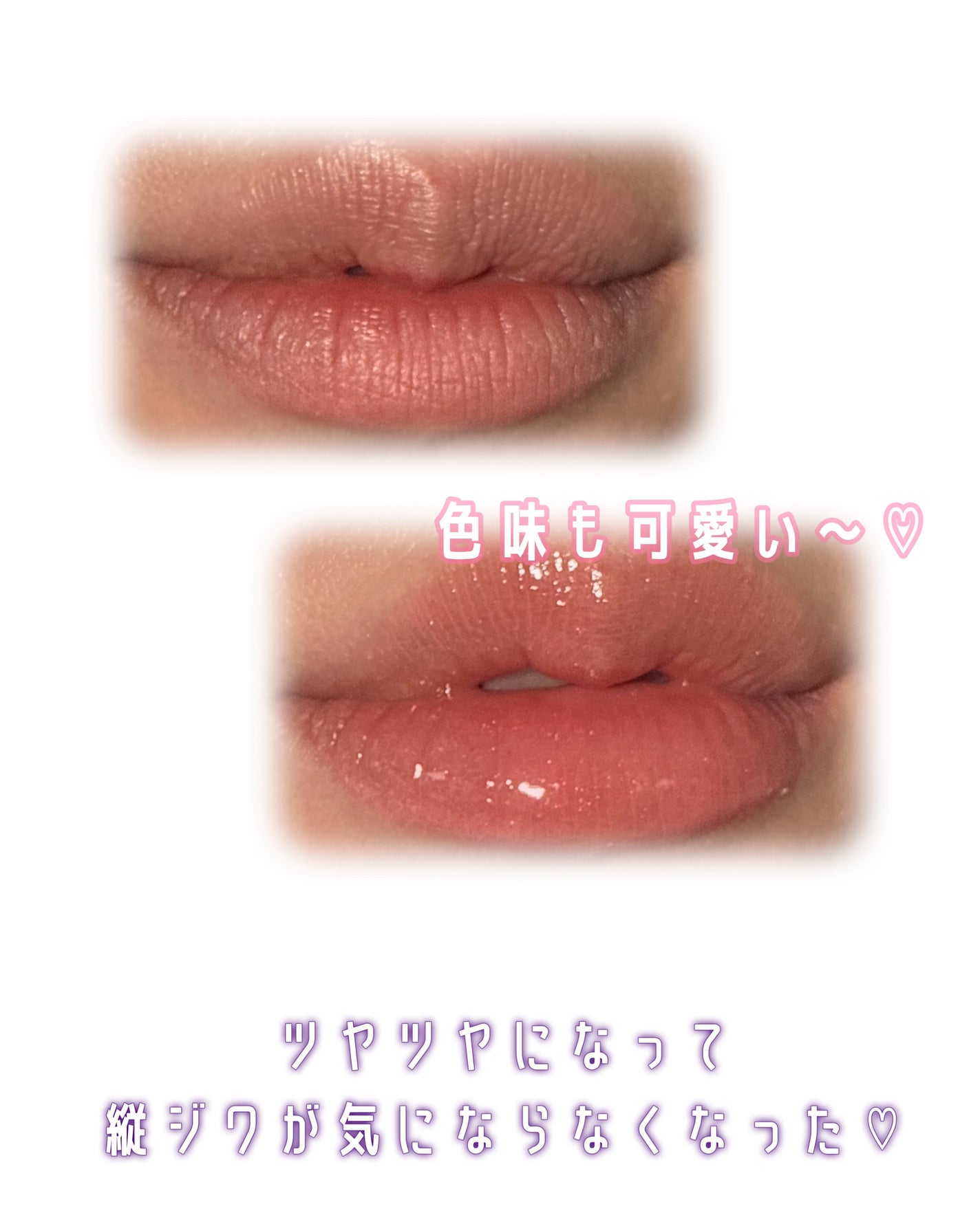 デューイー リッププランパー/FEMMUE/リッププランパーを使ったクチコミ(5枚目)