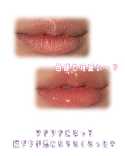 デューイー リッププランパー/FEMMUE/リッププランパーを使ったクチコミ(5枚目)