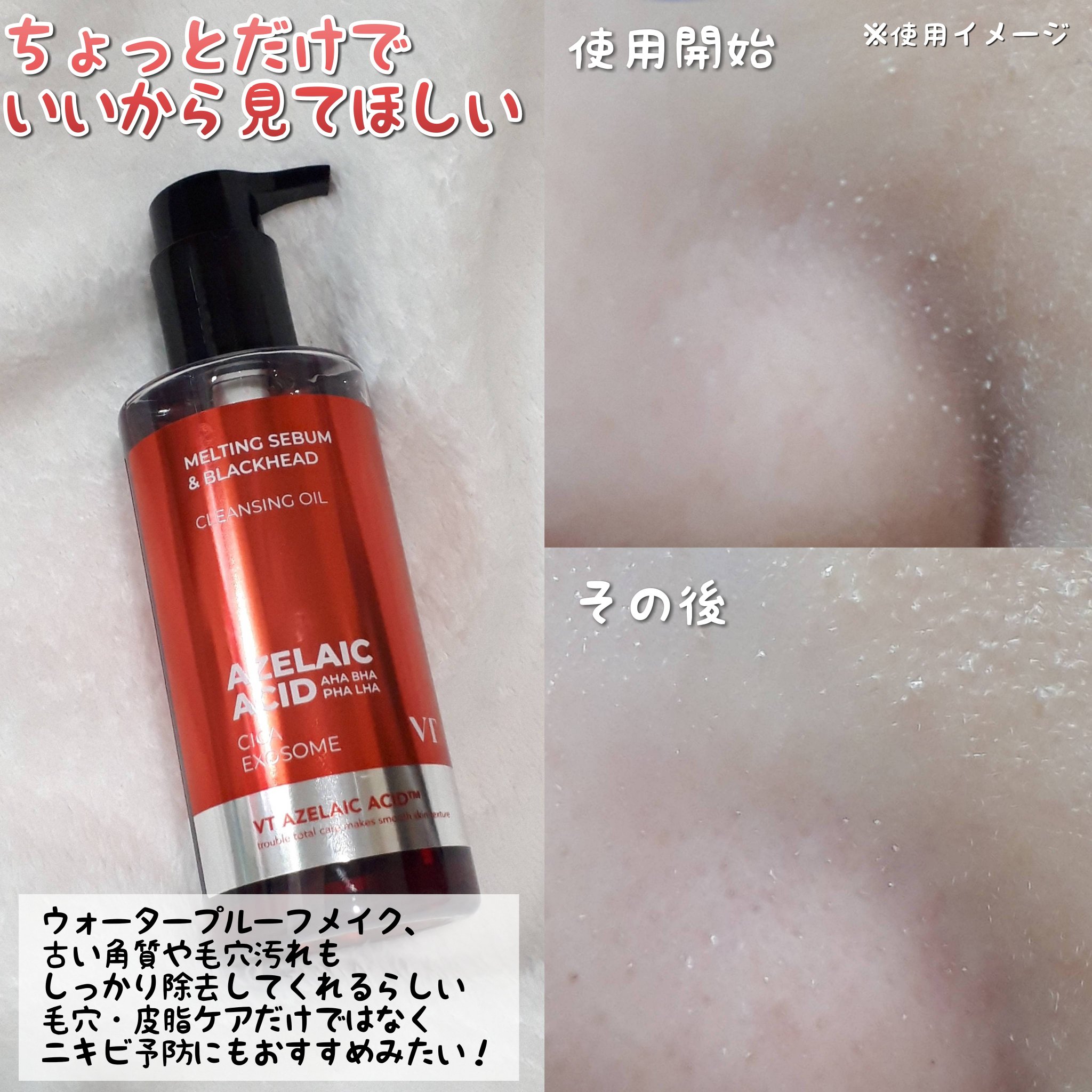 AZケア クレンジングオイル/VT/オイルクレンジングを使ったクチコミ（2枚目）