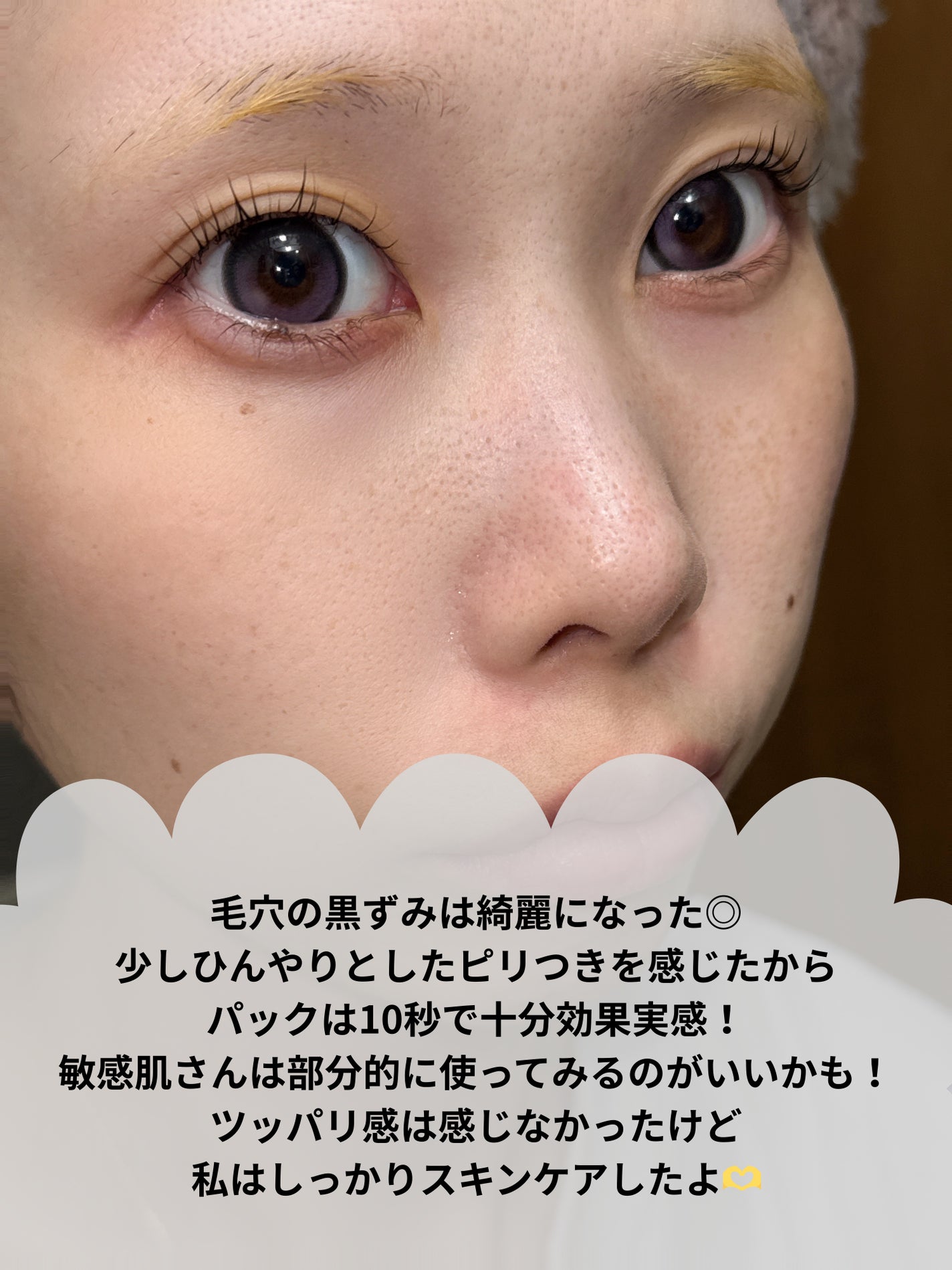 ディズム クリーミーフォームウォッシュ ブラック/DISM/泡洗顔を使ったクチコミ(6枚目)