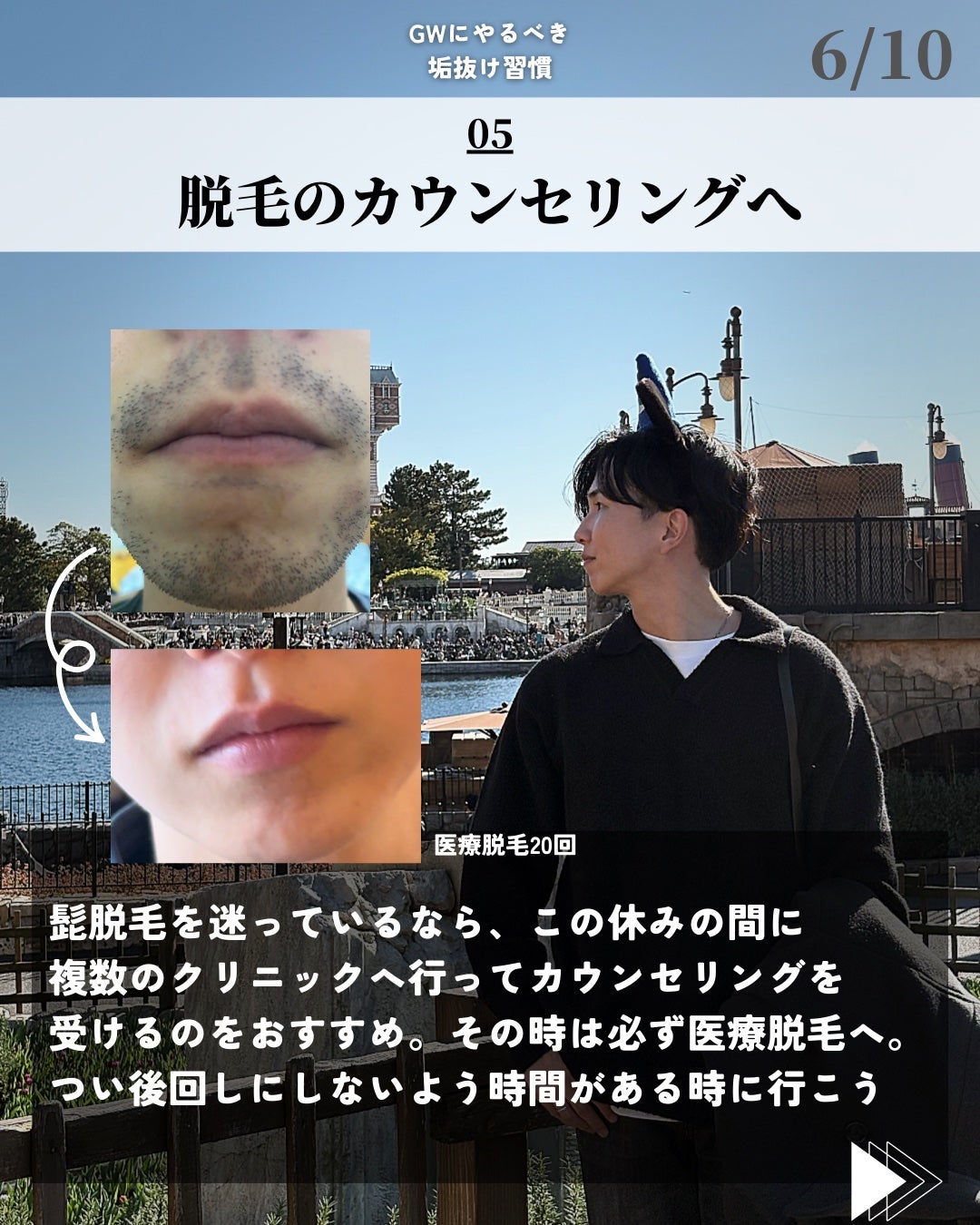 ほづ|メンズ美容で清潔感を上げる on LIPS 「@mens_biyou_hozu ←1.5倍カッコ良くなるメン..」(6枚目)