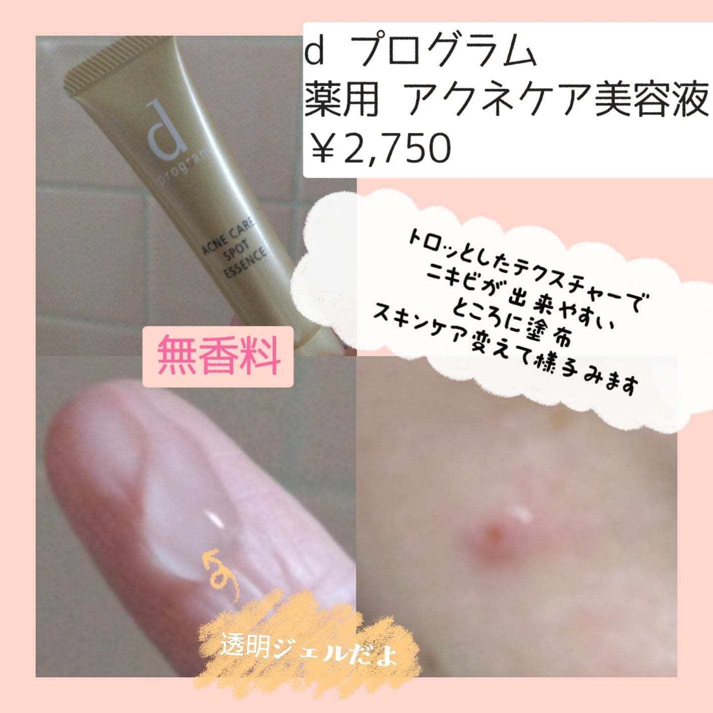 薬用 アクネケア美容液/d プログラム/美容液を使ったクチコミ(2枚目)