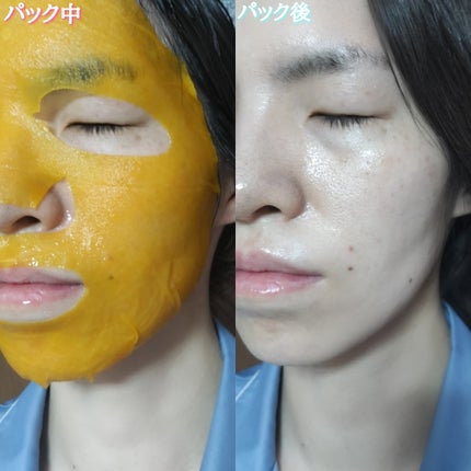 7DAYS メレーザー プログラミングマスク/athé/シートマスク・パックを使ったクチコミ(4枚目)