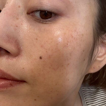 エファクラ ピールケア セラム/ラ ロッシュ ポゼ/美容液を使ったクチコミ(7枚目)