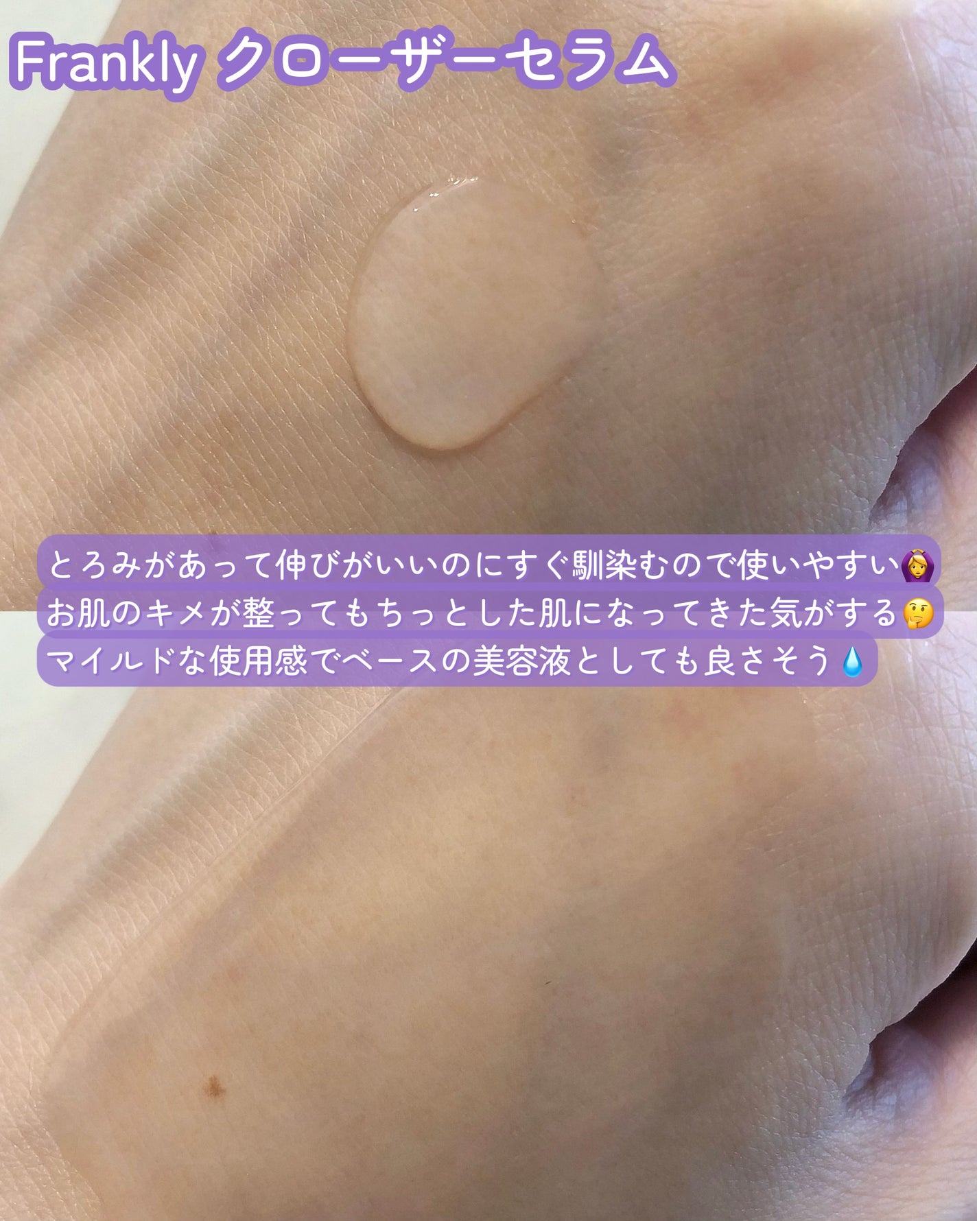 クローザーセラム/Frankly/美容液を使ったクチコミ(3枚目)