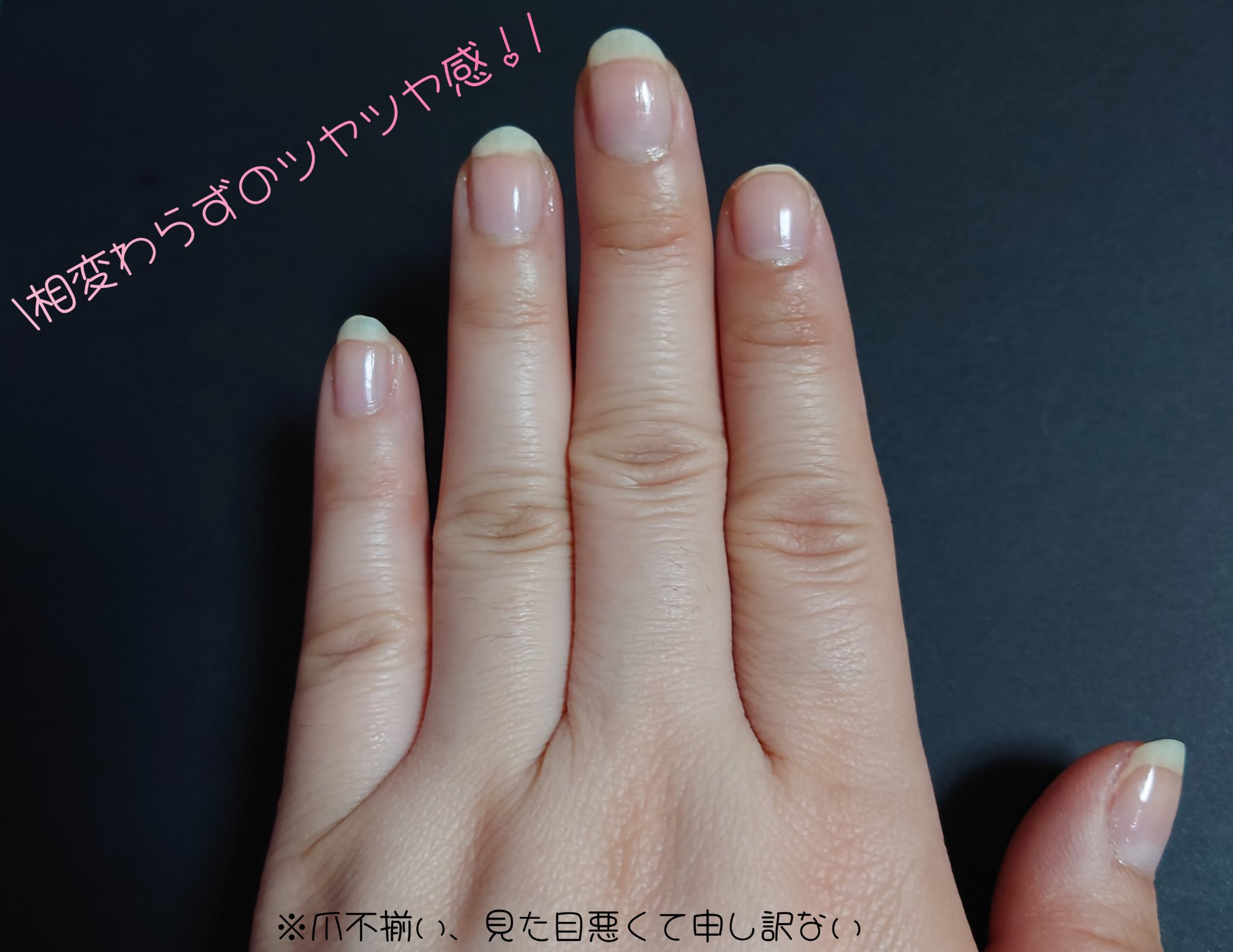 自爪補強コート/デュカート/ネイルベースコートを使ったクチコミ（2枚目）