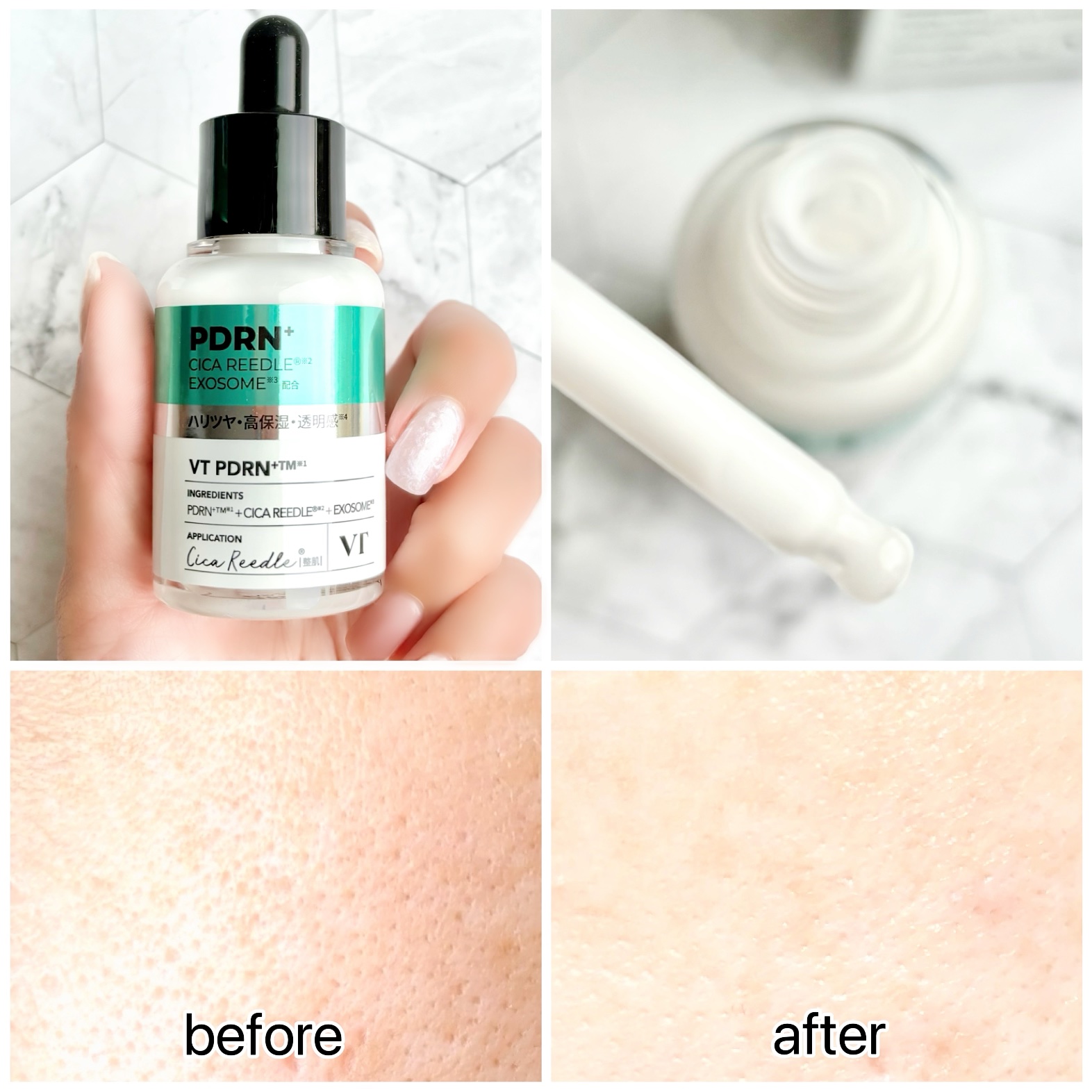 リードルS PDRN+ セラム/VT/美容液を使ったクチコミ（3枚目）