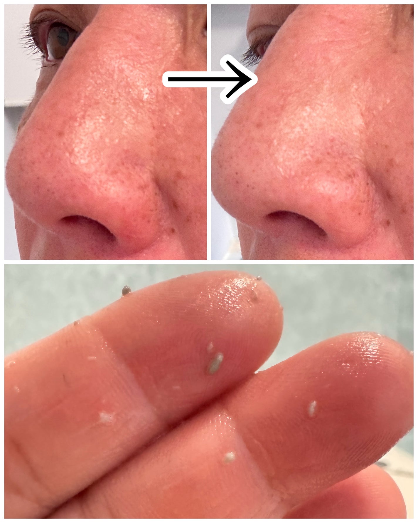 白米ピールショットゴマージュアンプル/Dr.Melaxin/美容液を使ったクチコミ(5枚目)