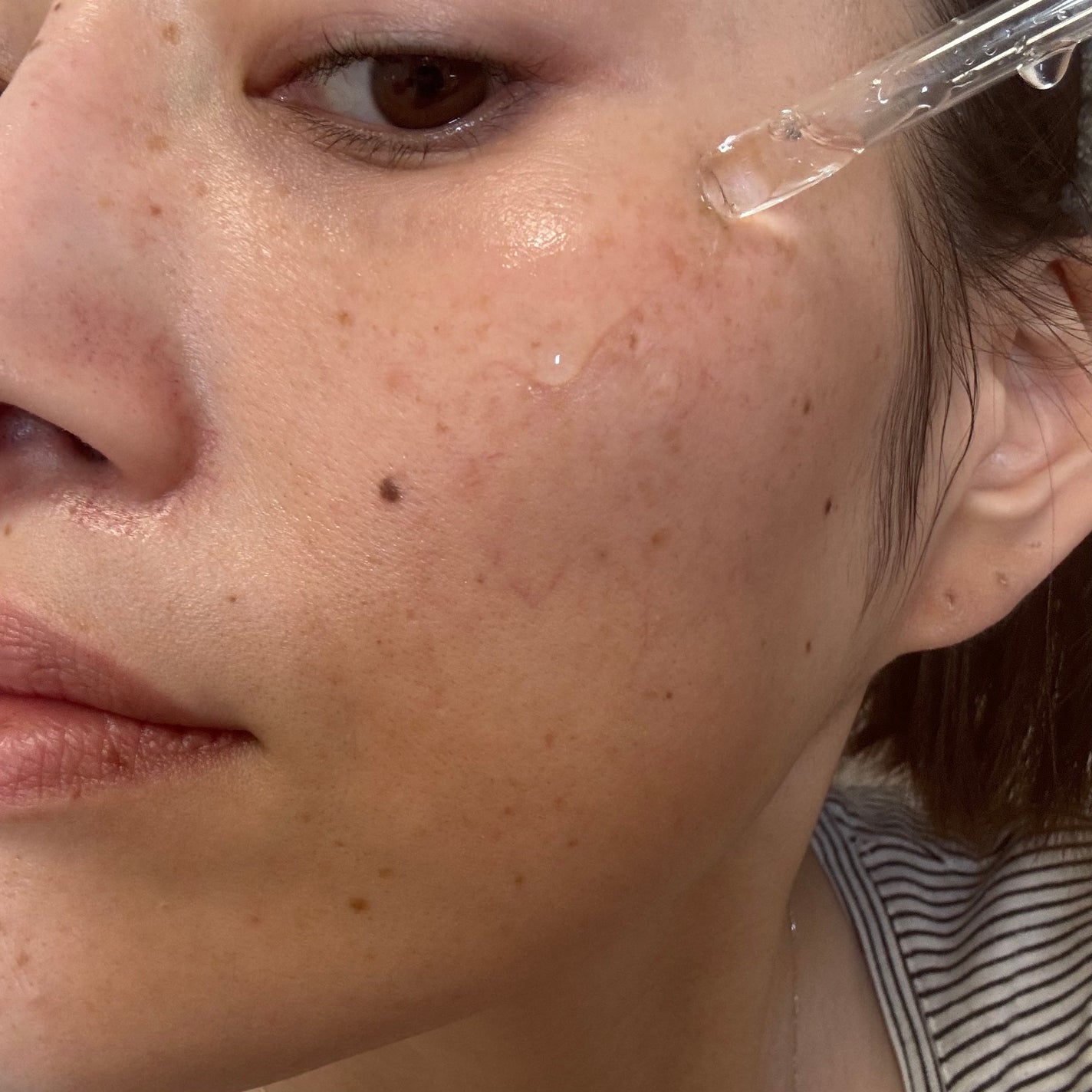 エファクラ ピールケア セラム/ラ ロッシュ ポゼ/美容液を使ったクチコミ(6枚目)