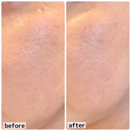 ãã·ã¥ãããã£ããã·ã¥ããŠã㌠mini/ãã£ã³ã¡ã€ã¯/ãã§ã€ã¹ããŠããŒã䜿ã£ãã¯ãã³ãïŒ4æç®ïŒ