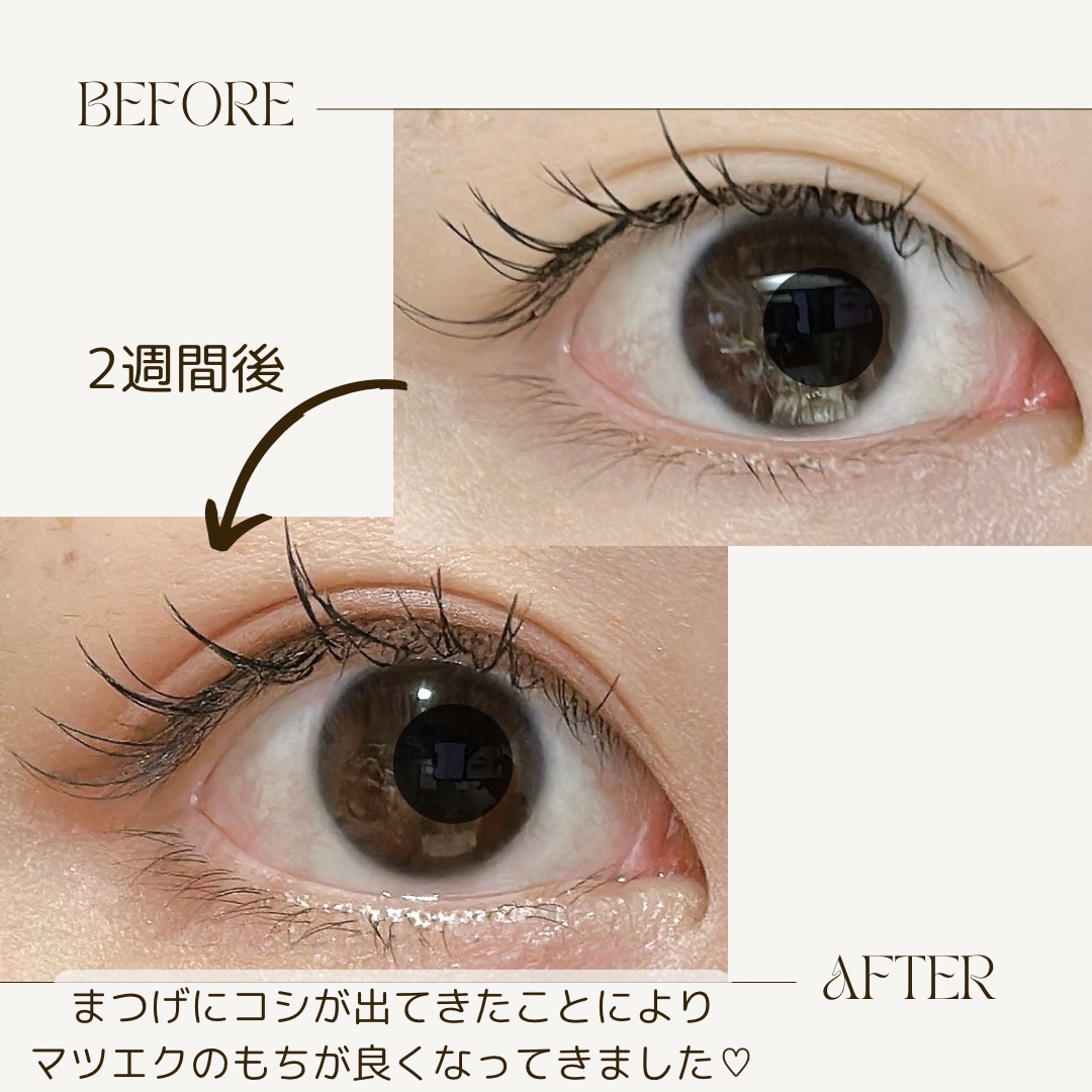 リアルミービオテノールラッシュアップアンプル/ベリサム/まつげ美容液を使ったクチコミ（2枚目）