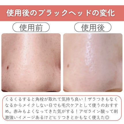 AZケア クレンジングオイル/VT/オイルクレンジングを使ったクチコミ(4枚目)