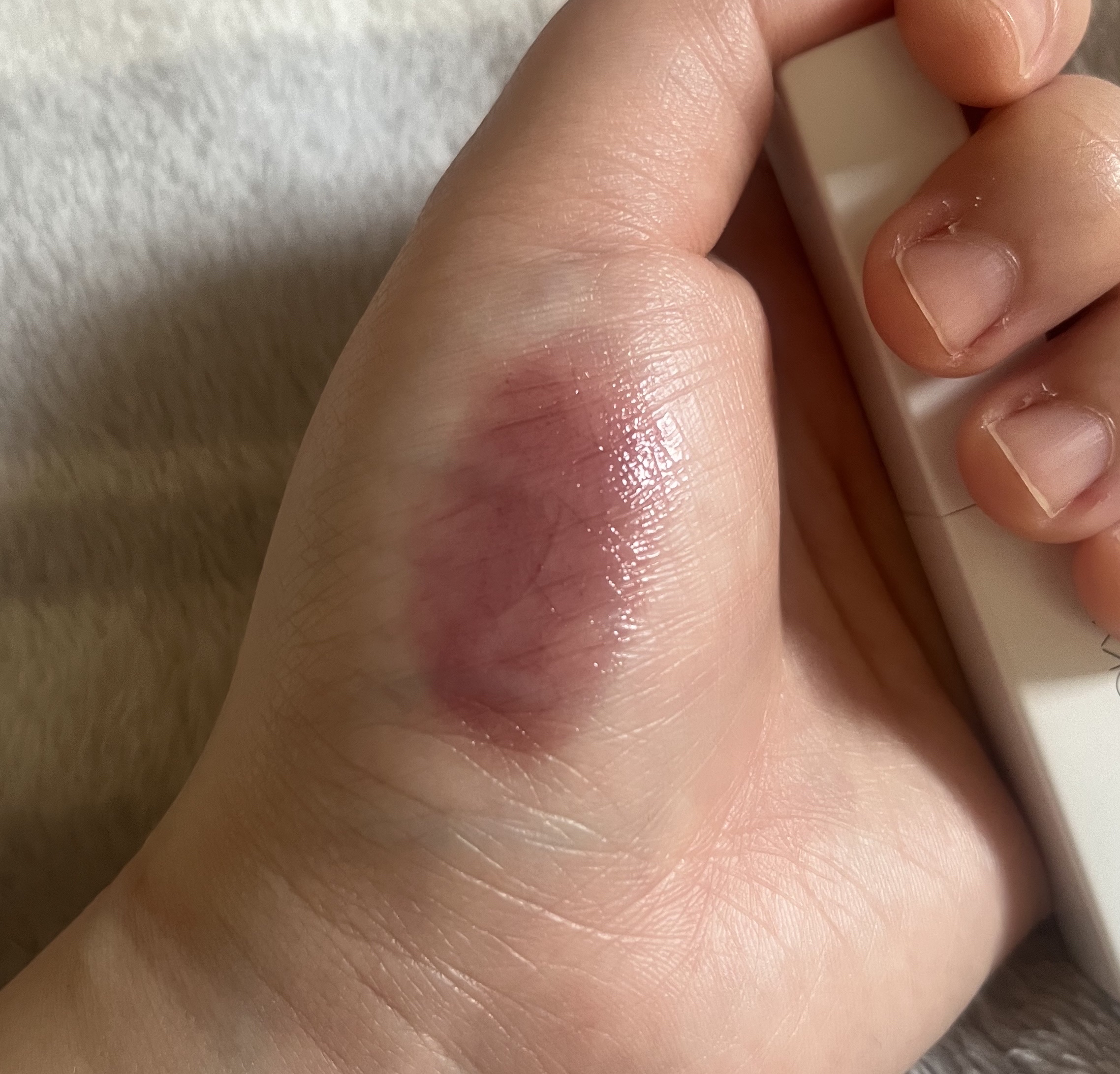 アディクション ザ リップバーム グロウティント/ADDICTION/リップティントを使ったクチコミ（3枚目）