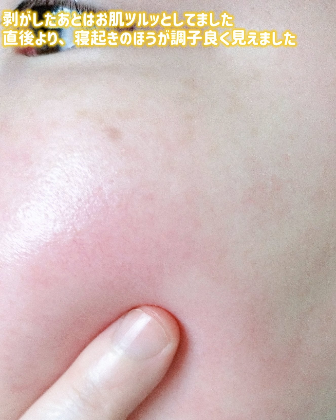 ビタナイアシンアミド リアルディープマスク/Biodance/シートマスク・パックを使ったクチコミ(8枚目)