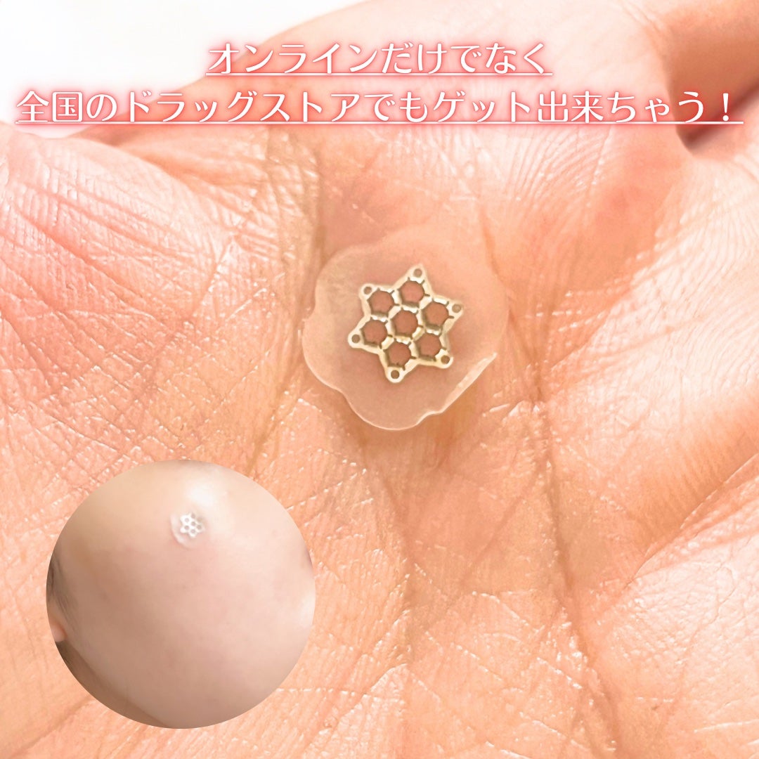 ACマグネシウムパッチ/スノーツープラス/シートマスク・パックを使ったクチコミ(6枚目)