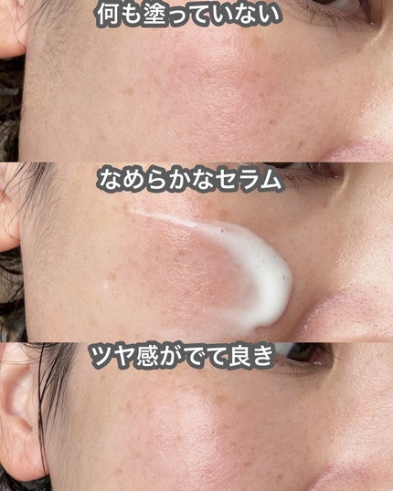 SOOTHING REPAIR TONING SERUM R4/ダーマファーム/美容液を使ったクチコミ(6枚目)