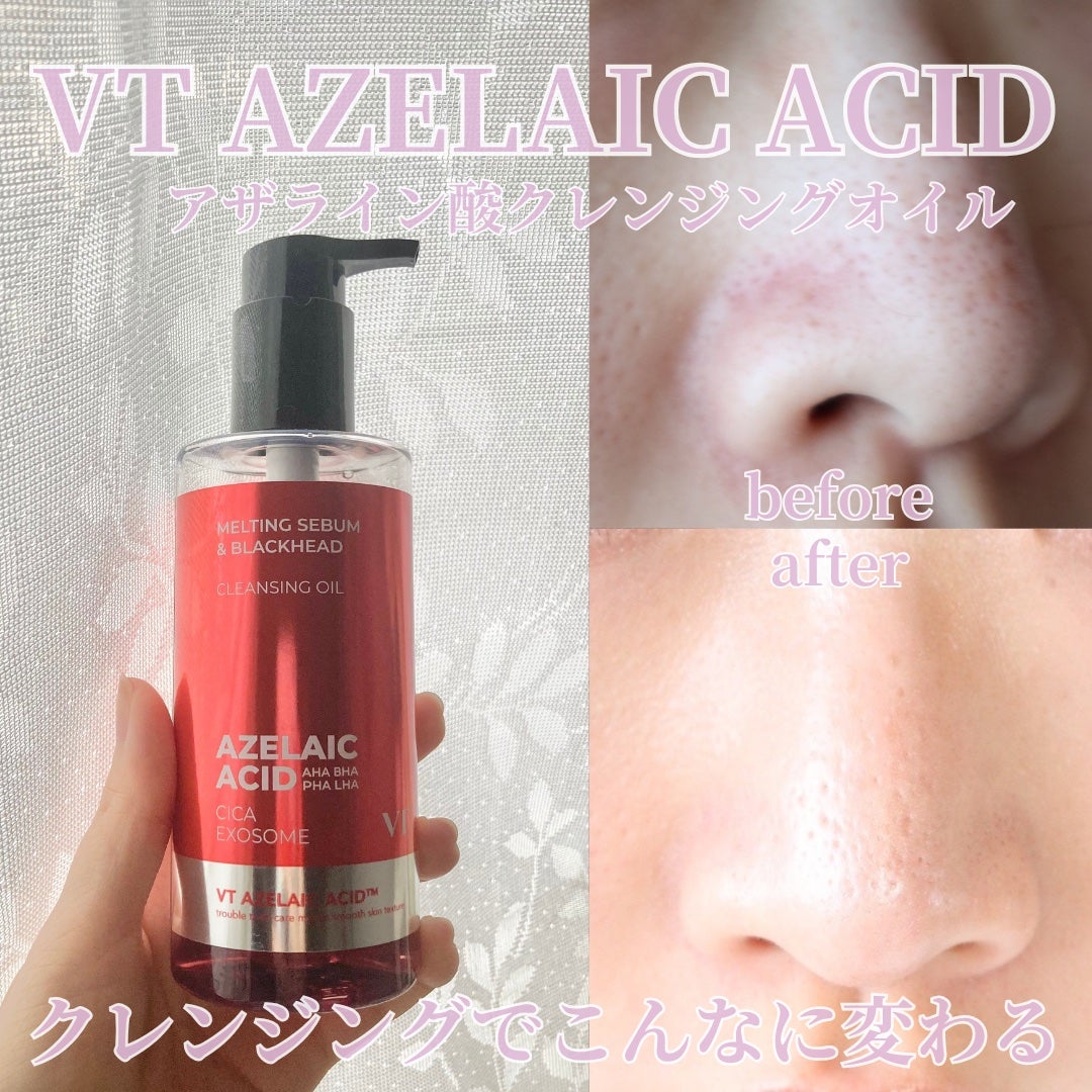 AZケア クレンジングオイル/VT/オイルクレンジングを使ったクチコミ(1枚目)