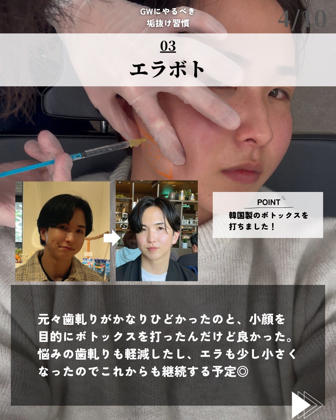 ほづ|メンズ美容で清潔感を上げる on LIPS 「@mens_biyou_hozu ←1.5倍カッコ良くなるメン..」(4枚目)