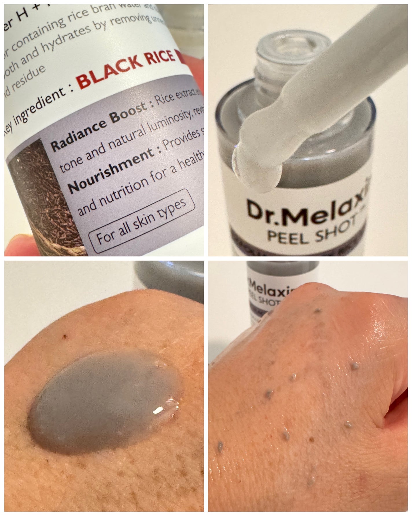 白米ピールショットゴマージュアンプル/Dr.Melaxin/美容液を使ったクチコミ(4枚目)