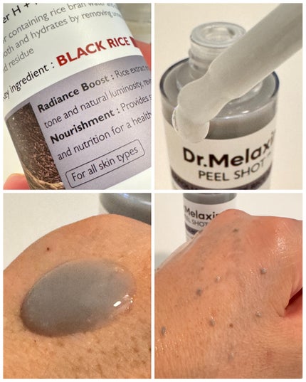 白米ピールショットゴマージュアンプル/Dr.Melaxin/美容液を使ったクチコミ(4枚目)