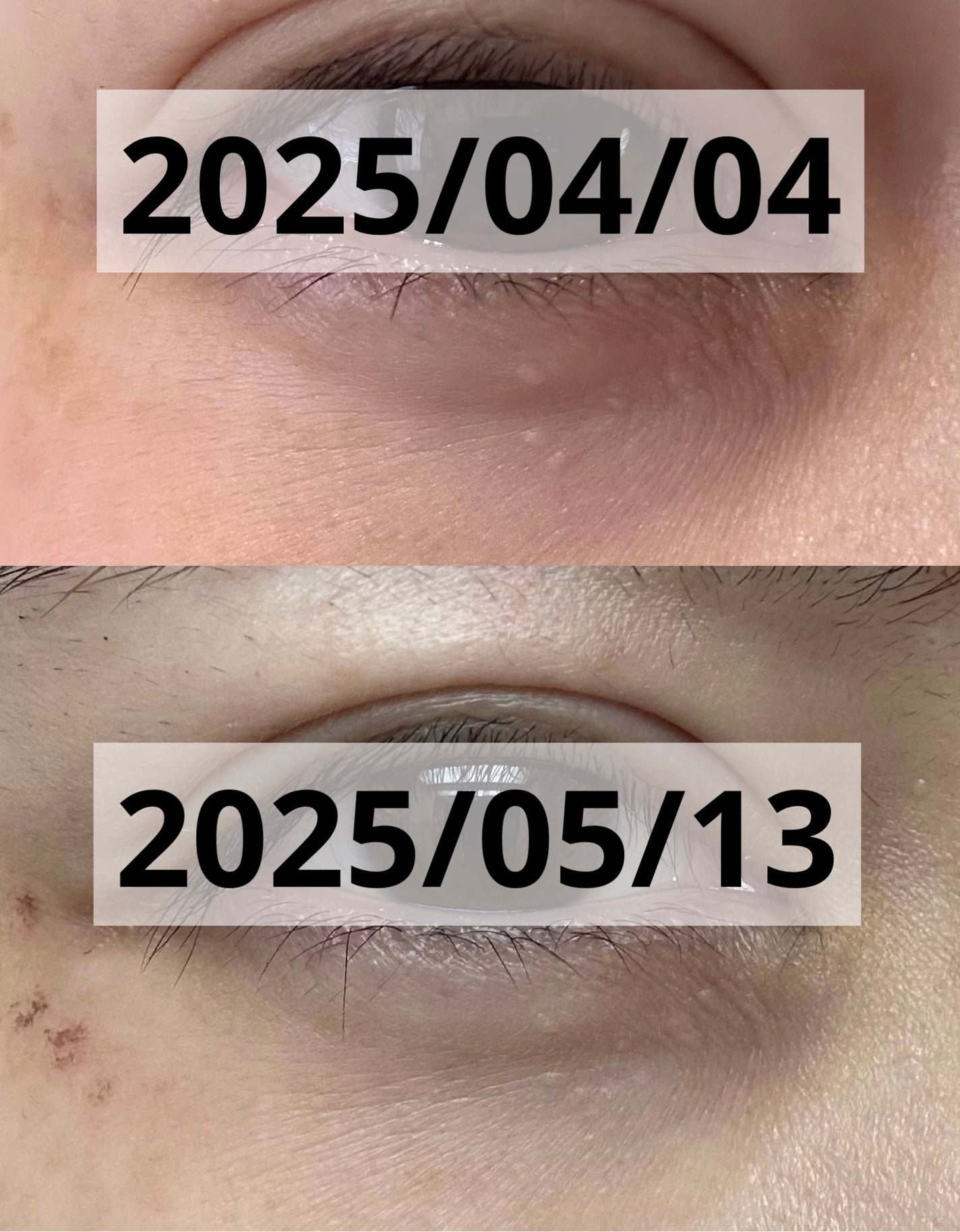 レチノパワー リンクルクリーム /エリクシール/アイケア・アイクリームを使ったクチコミ(2枚目)