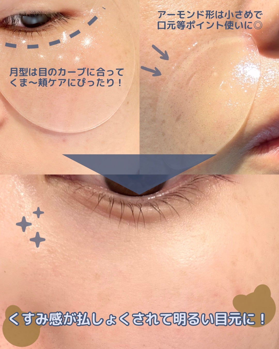 グルタチオンダークゼロトーニングパッチ/SNP/アイケア・アイクリームを使ったクチコミ(4枚目)