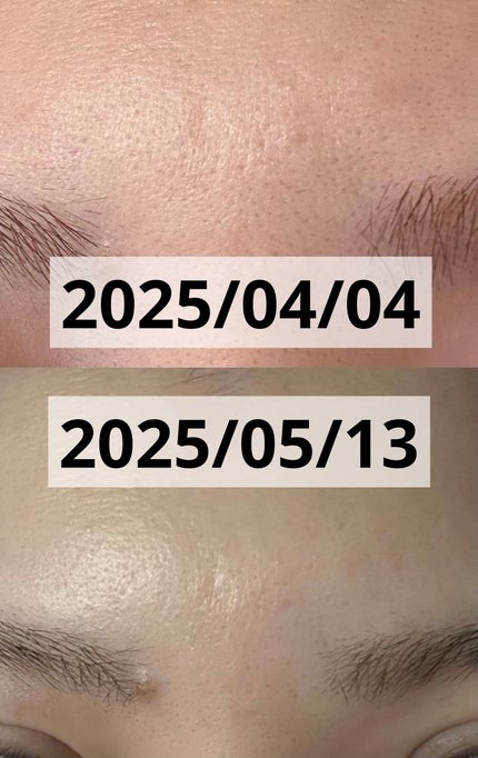 レチノパワー リンクルクリーム /エリクシール/アイケア・アイクリームを使ったクチコミ(4枚目)