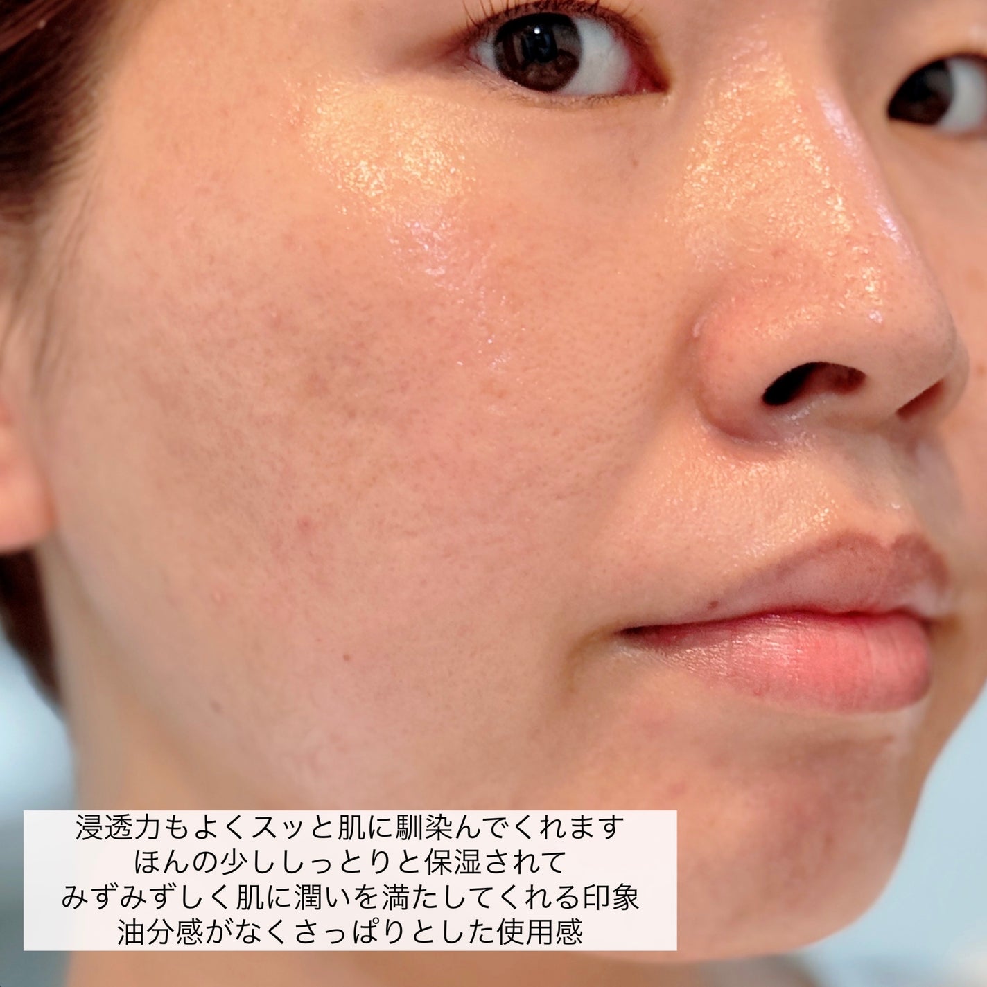 薬用 スキントリートメント/アトレージュ AD+/化粧水を使ったクチコミ(7枚目)