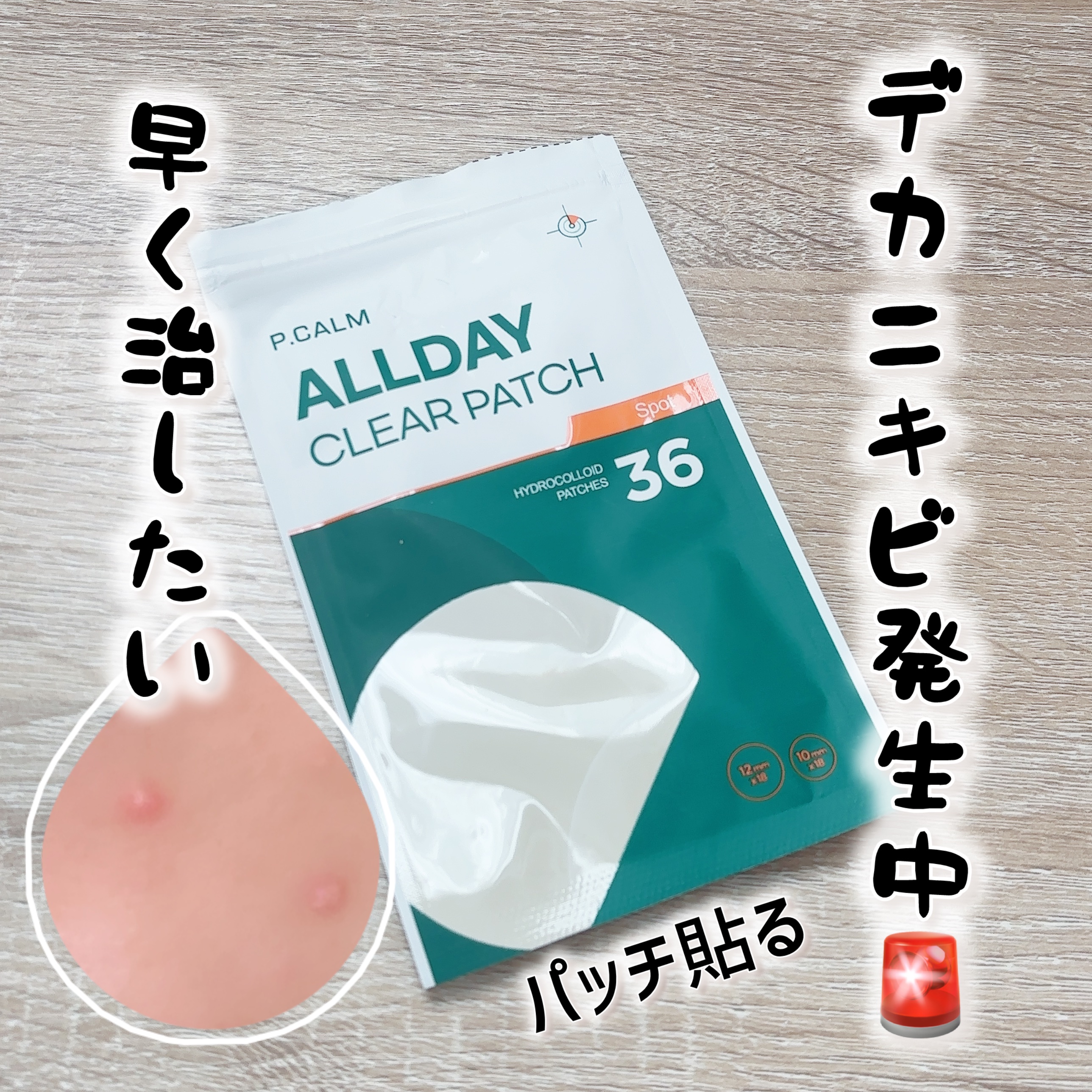 ALLDAY CLEAR PATCH/P.CALM/にきびパッチを使ったクチコミ（1枚目）