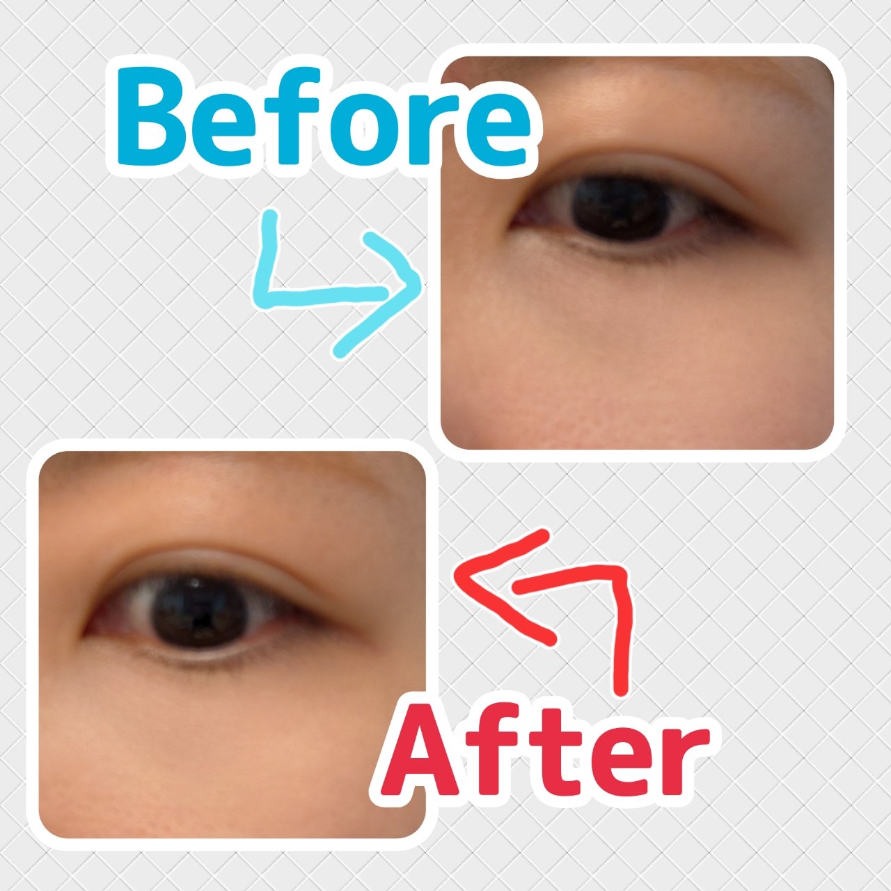 クマメンテパウダー/muice/パウダーコンシーラーを使ったクチコミ（3枚目）