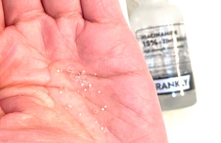 ナイアシンジンクビーズセラム/Frankly/美容液を使ったクチコミ(2枚目)