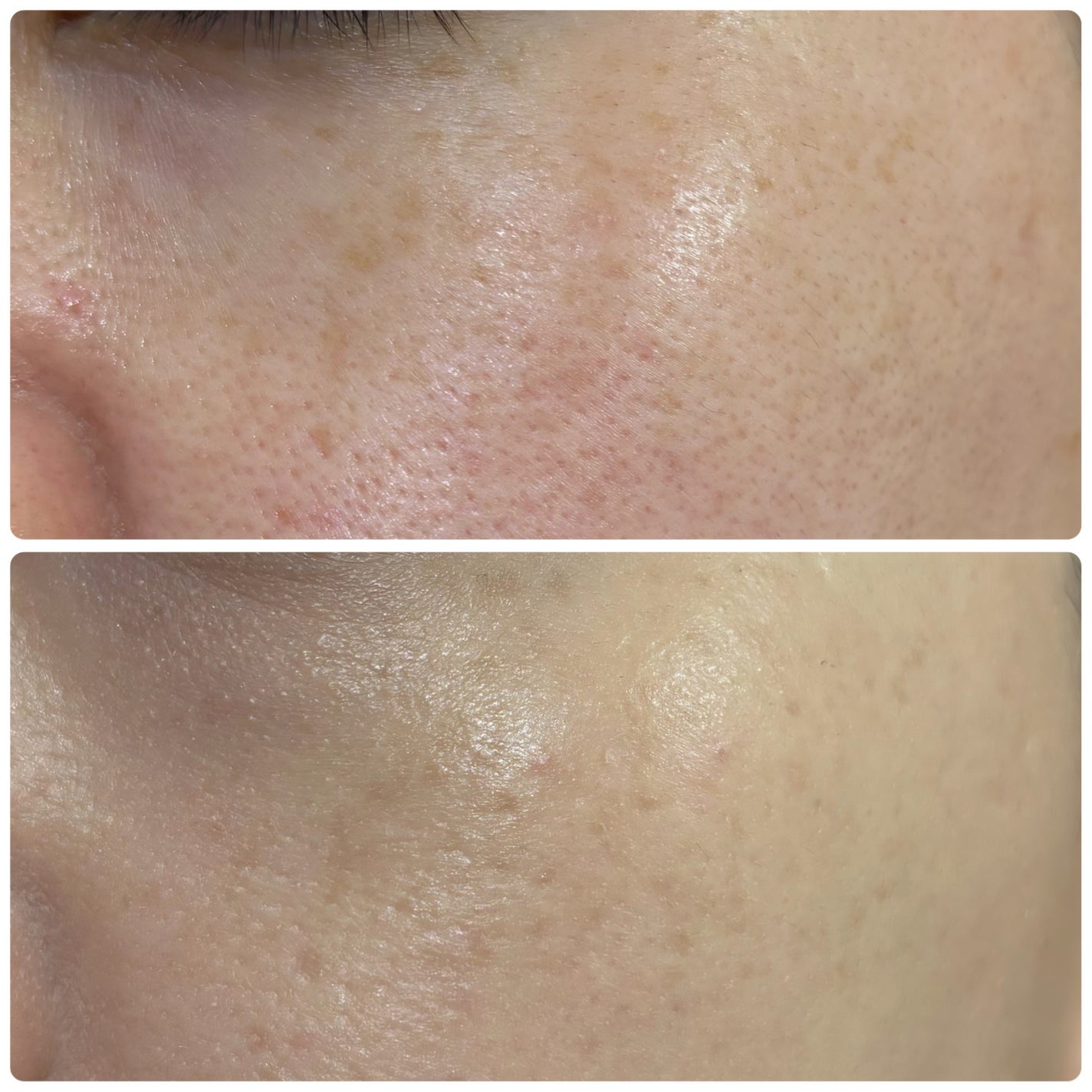 クラウドフィルタークッション/ETUDE/クッションファンデーションを使ったクチコミ(6枚目)