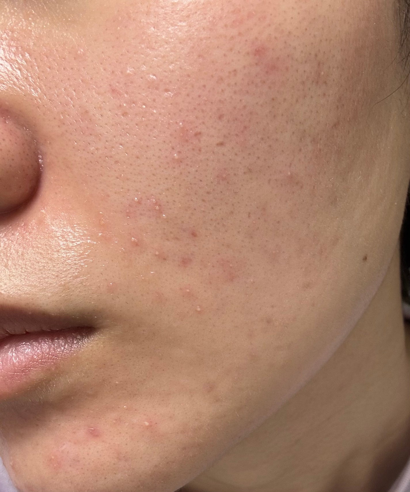 ライス70インテンシブモイスチャーライジングミルクマスク/Anua/シートマスク・パックを使ったクチコミ(3枚目)